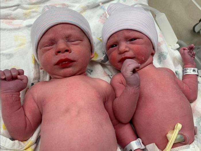 Luar Biasa! Bayi Kembar dari Pembekuan Embrio Selama 30 Tahun Lahir dengan Selamat